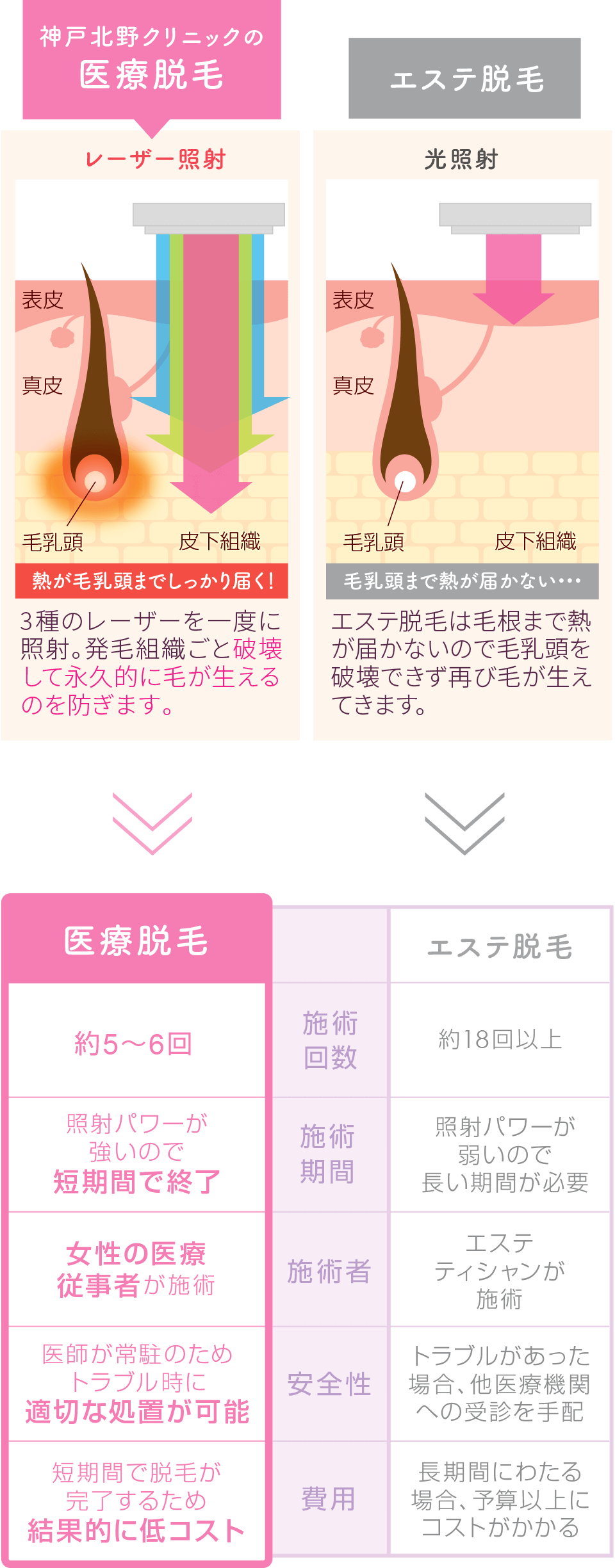 神戸北野クリニックの医療脱毛 エステ脱毛