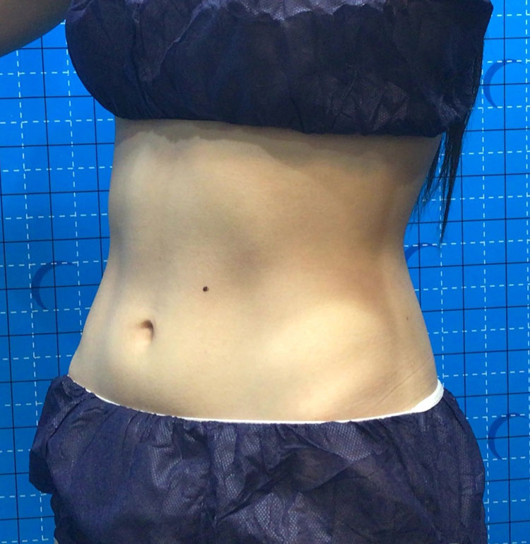 女性After